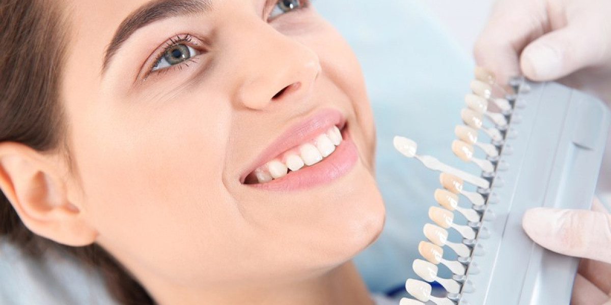 Dental Implant Surgery Guide for Stronger Smiles