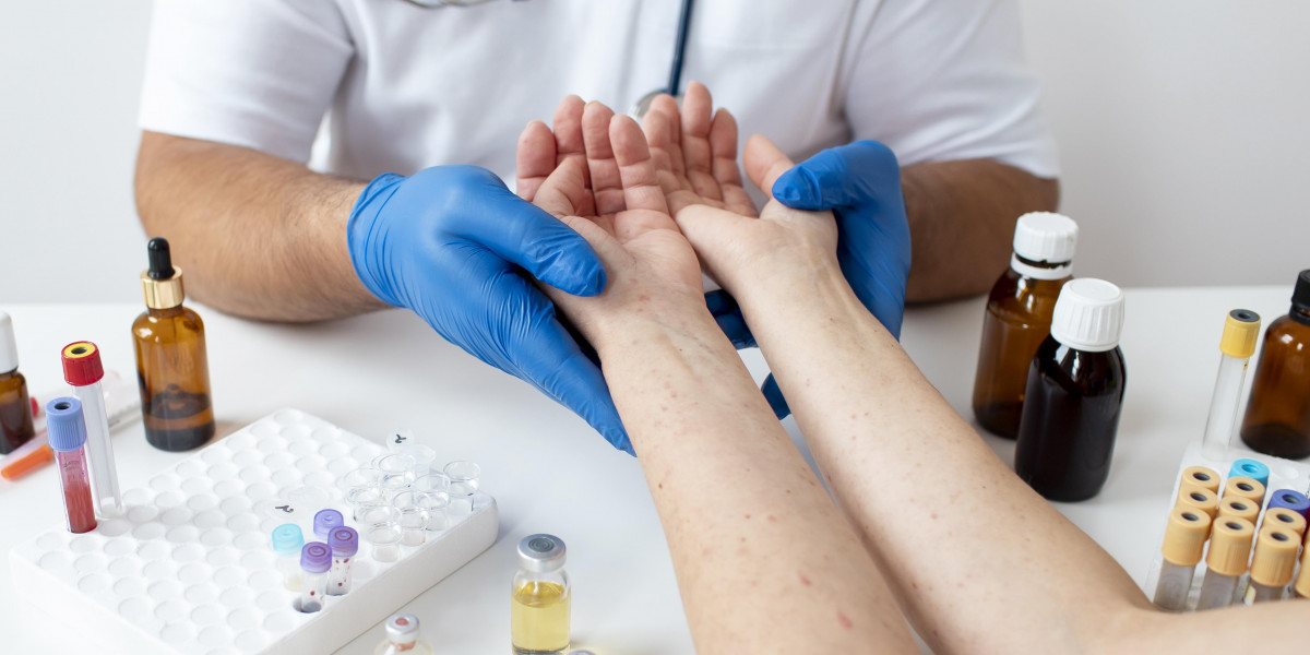 Struggling with Chronic Hives? How urticaria specialists Can Transform Your Skin Health