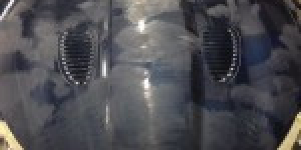 Car Dent Removal Spalding | Expert Dent Repair Services