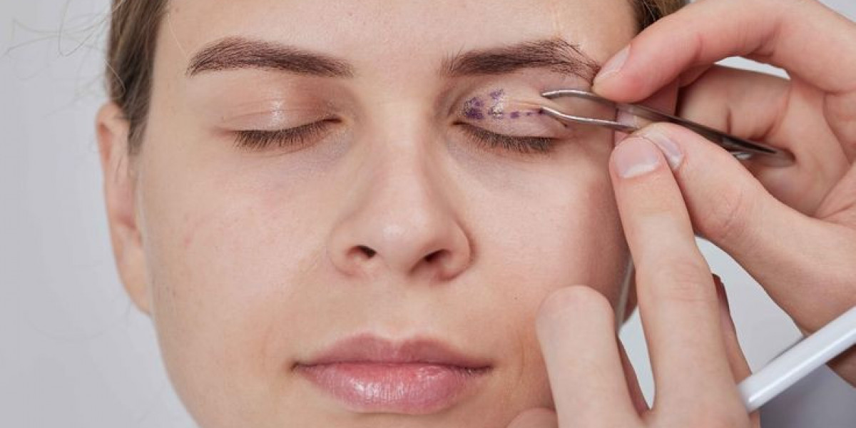 Unlock a Brighter Facial Expression with Expert Eye Lid Enhancement
