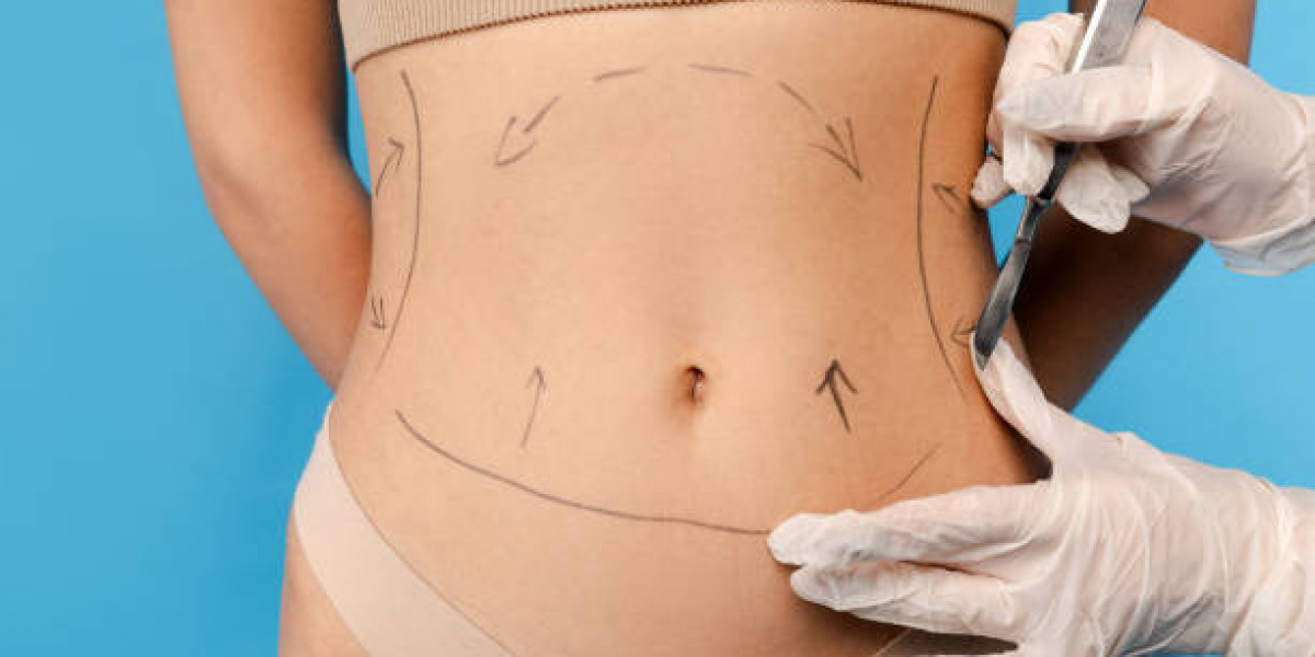 Discover How Fat Melting Injections Enhance Body Silhouette
