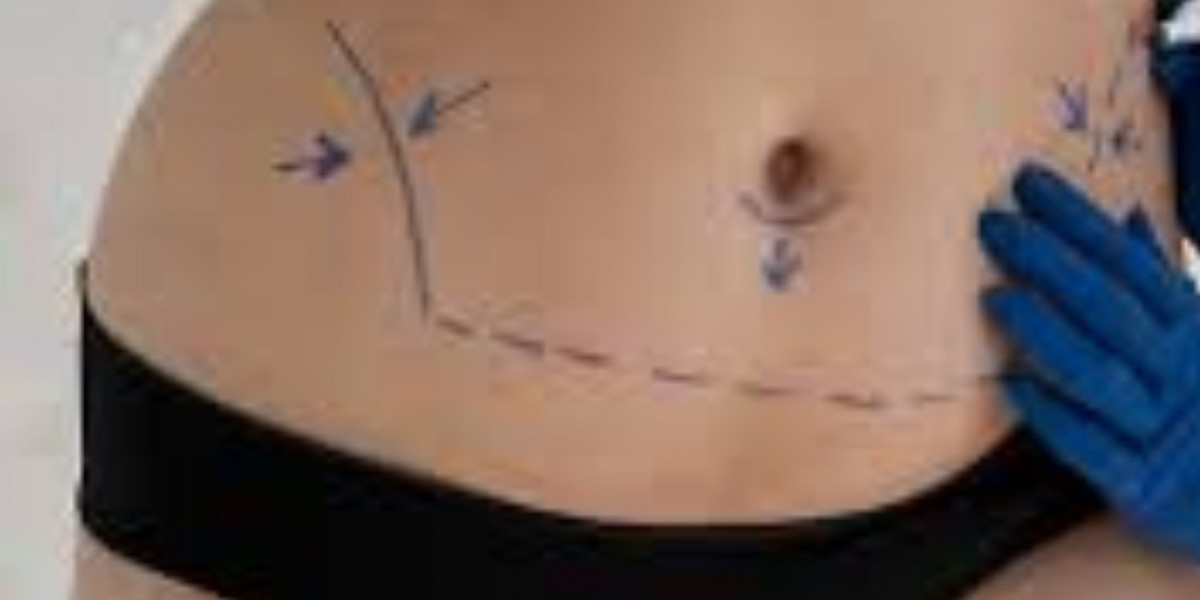 Six Pack Surgery Clinic in Istanbul: Step Guide, Care, and Safety