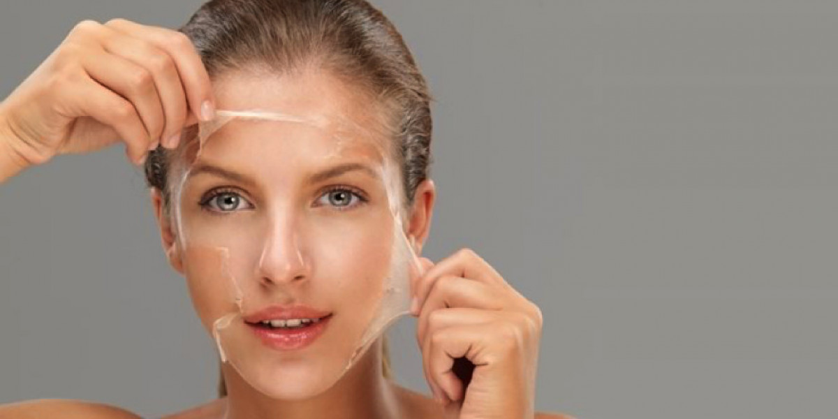 Salicylic vs Glycolic vs Lactic Acid Peels: What’s the Difference?