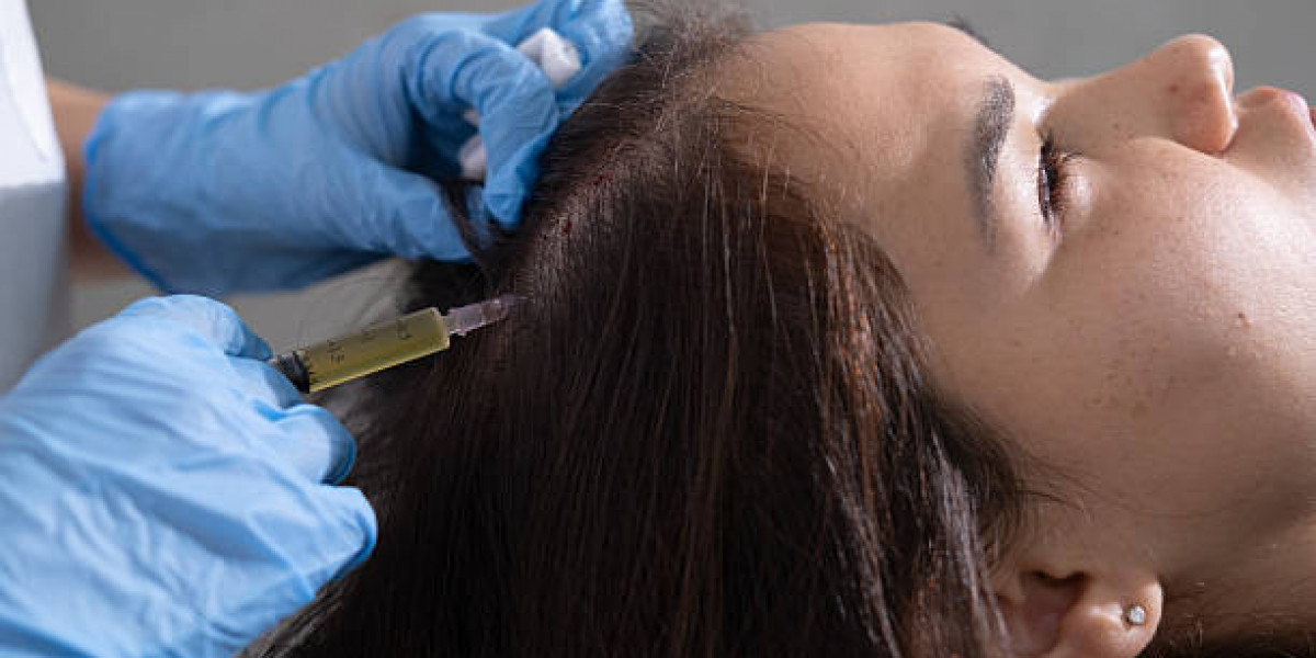 The Safety and Effectiveness of PRP Hair Treatment in Riyadh