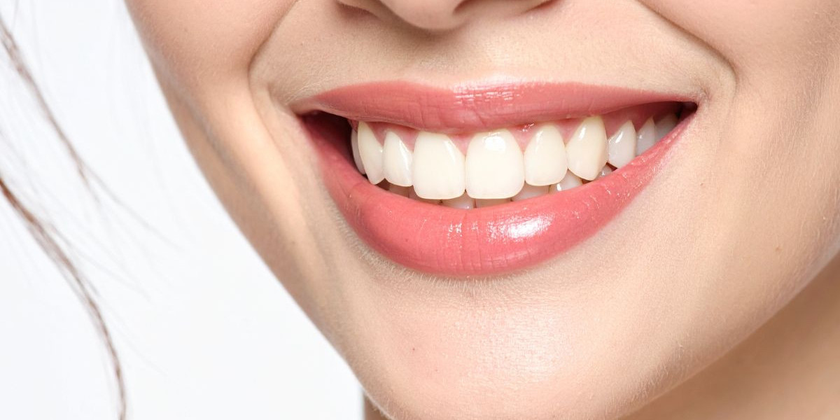 From Damaged Teeth to a Perfect Smile: The Power of Full Mouth Reconstruction in Bangalore
