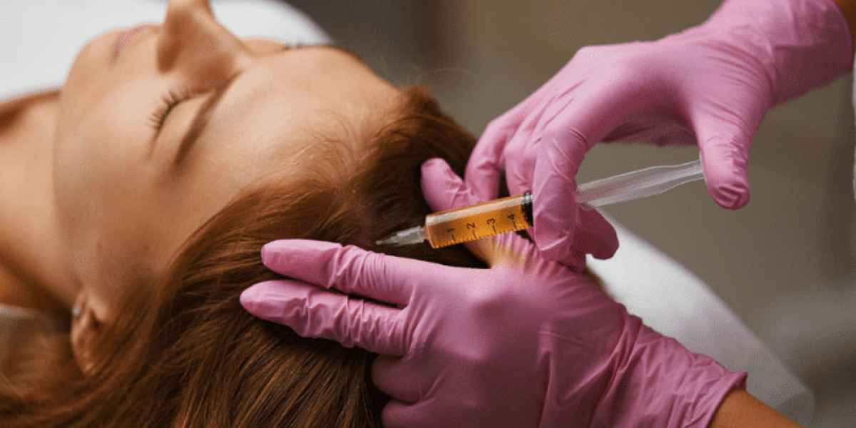 Achieve Luscious Locks with PRP's Natural Healing Process