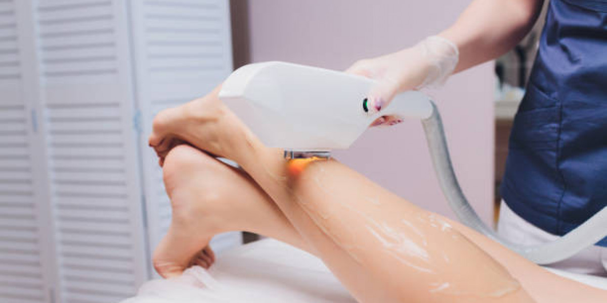 Laser Hair Removal for Hands and Fingers: Precision Care