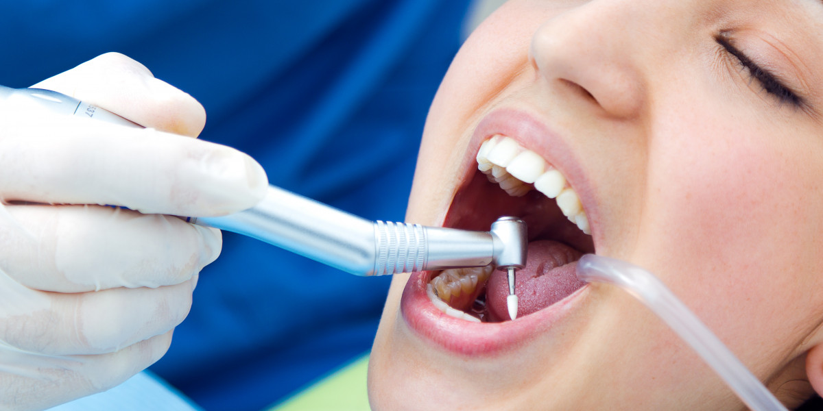 How Long Does a Root Canal Take? A Woodbridge VA Dentist Explains
