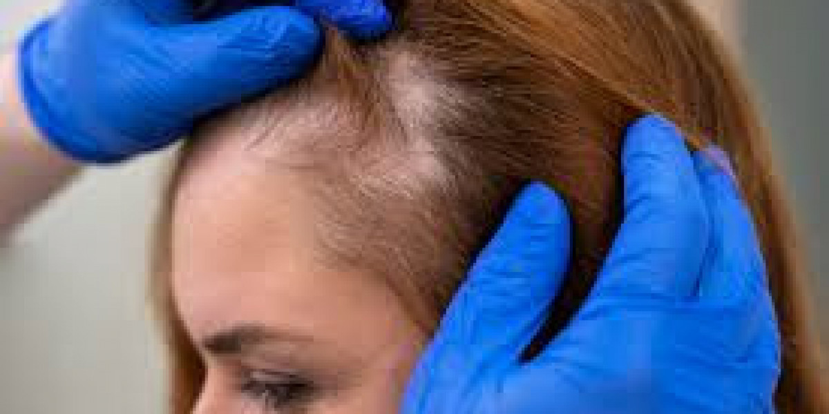Everything You Need to Know About Hair Thinning Treatment