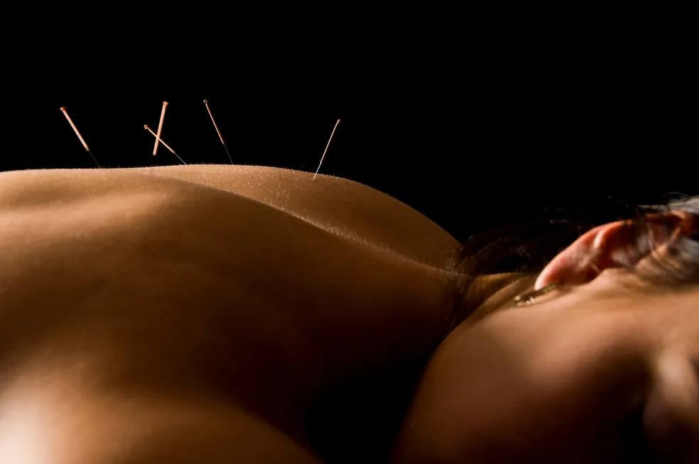 Grand Madison Acupuncture