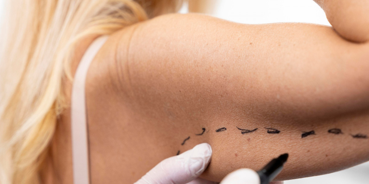 Arm Lift Surgery in Istanbul: Skin Removal, Step Plan, and Healing Guide